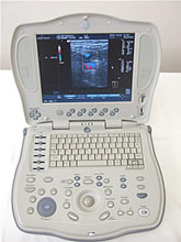 カラードップラー超音波診断装置